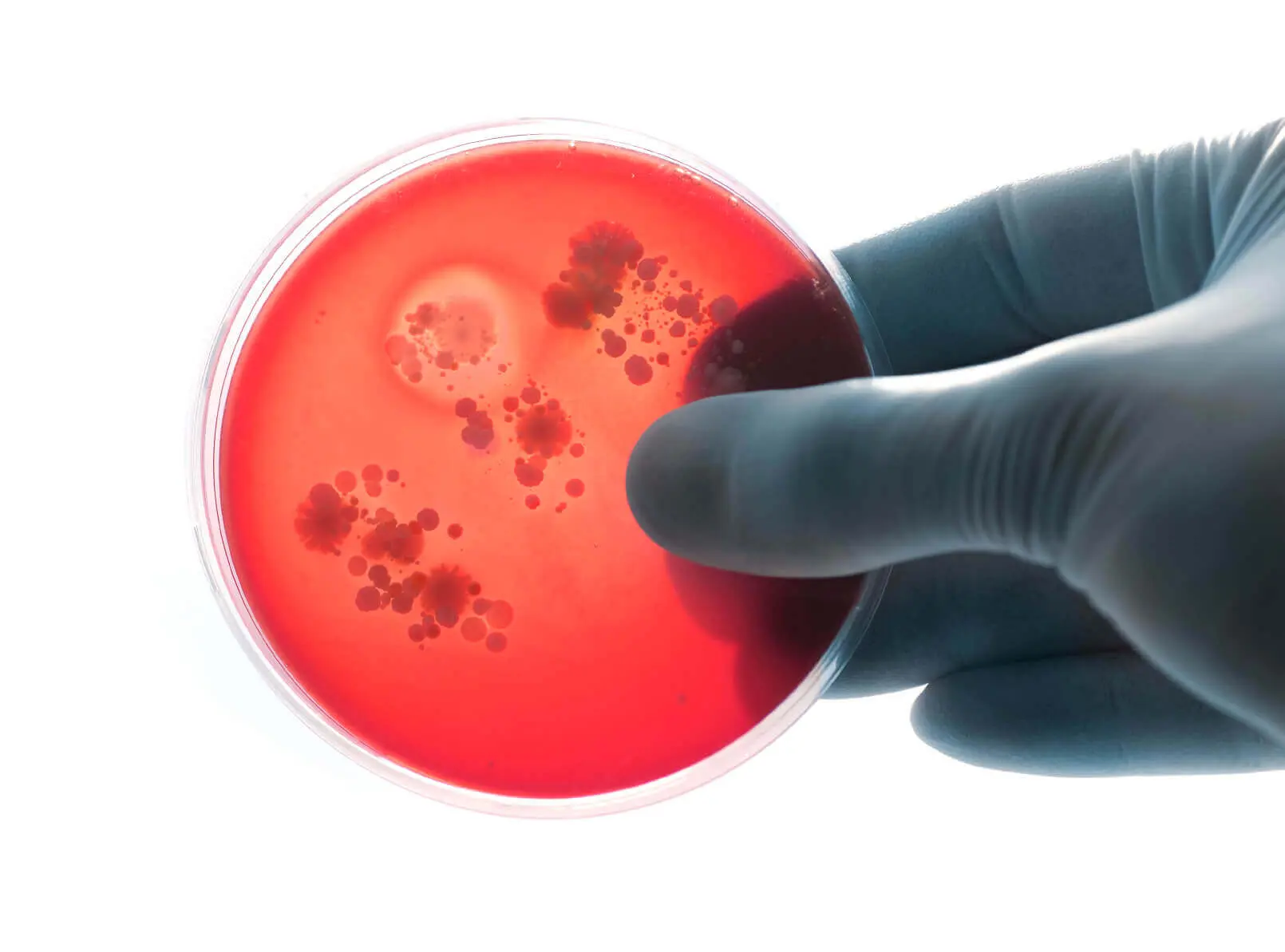 Blog 12 Gloved hands holding a bacteria plate