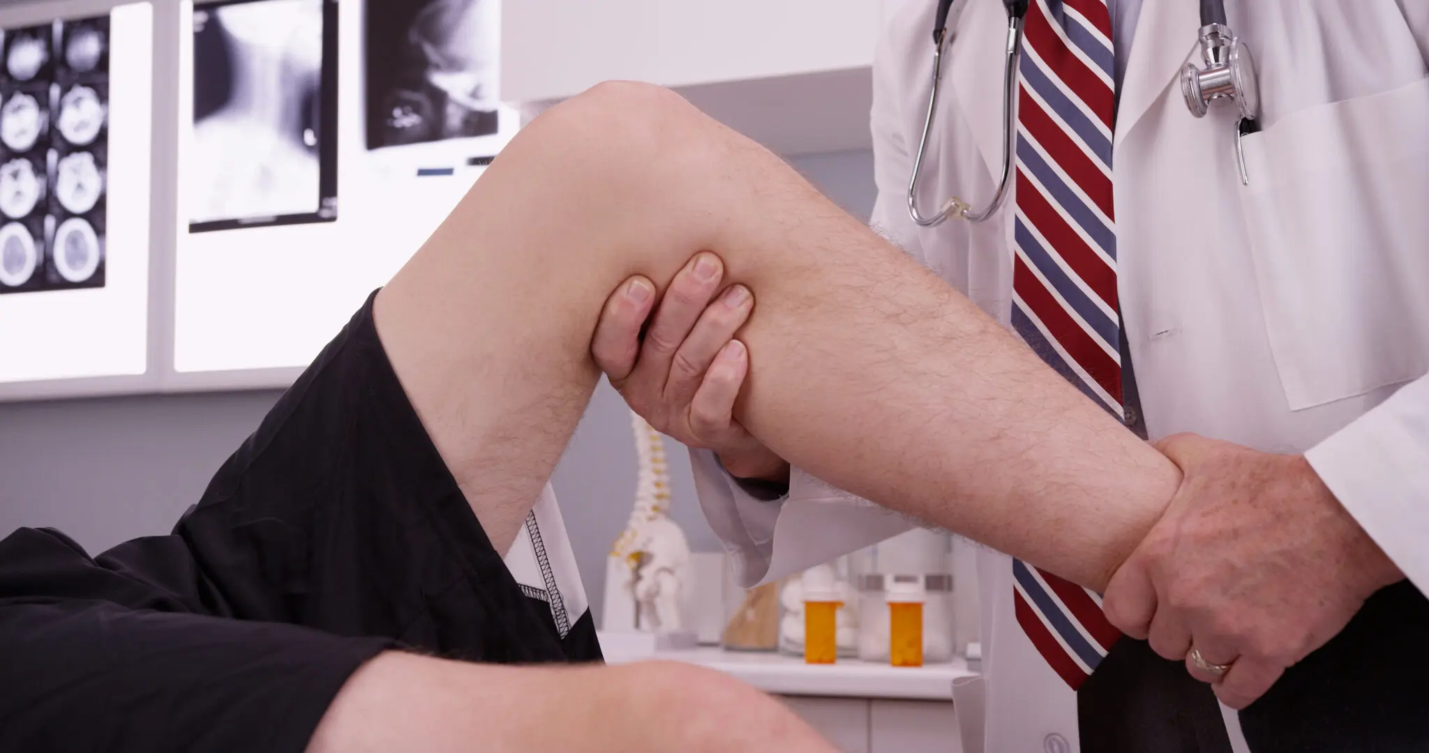 Knee Injuries 1 Knee Injuries AdobeStock 104436266 scaled