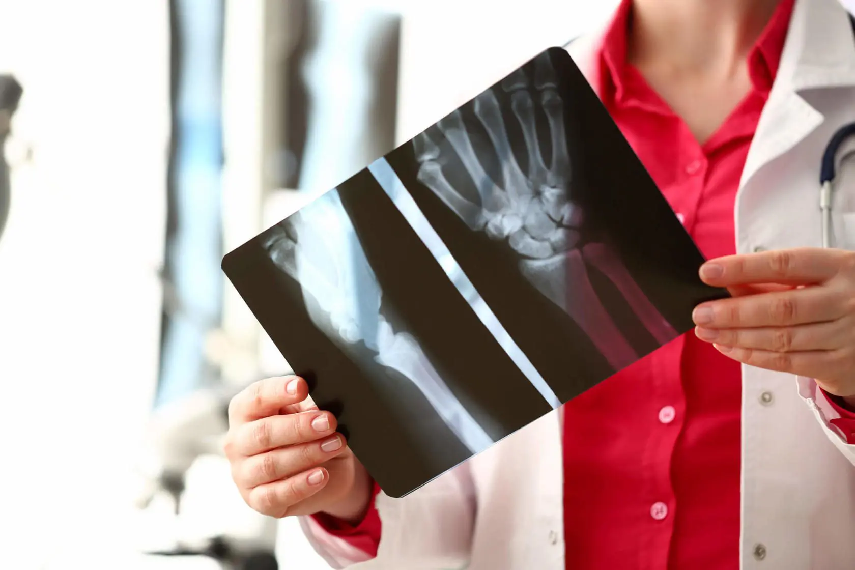 Company Vehicle Accident Lawyers 11 fracture and soft tissue injury lawyers