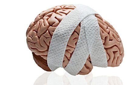 Blog 1 Human brain wrapped in bandages.