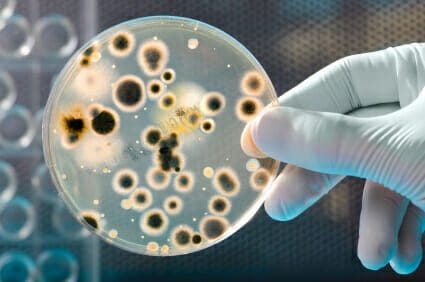 Blog 15 Medical professional holding a petri dish containing specimen.