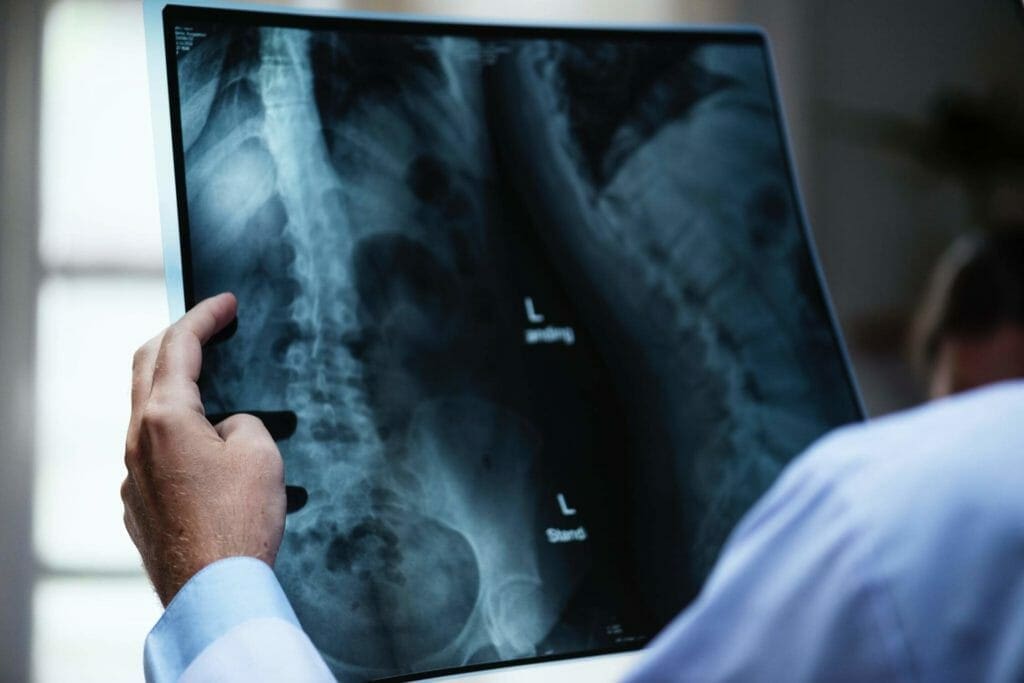 Common Causes of Spinal Cord Injuries 2 Common Causes of Spinal Cord Injuries pexels photo 721166