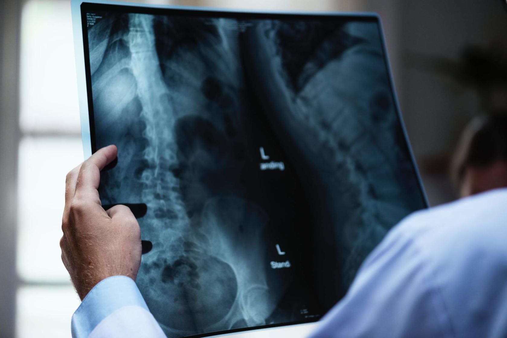 Blog 7 Doctor reading a spinal X-ray