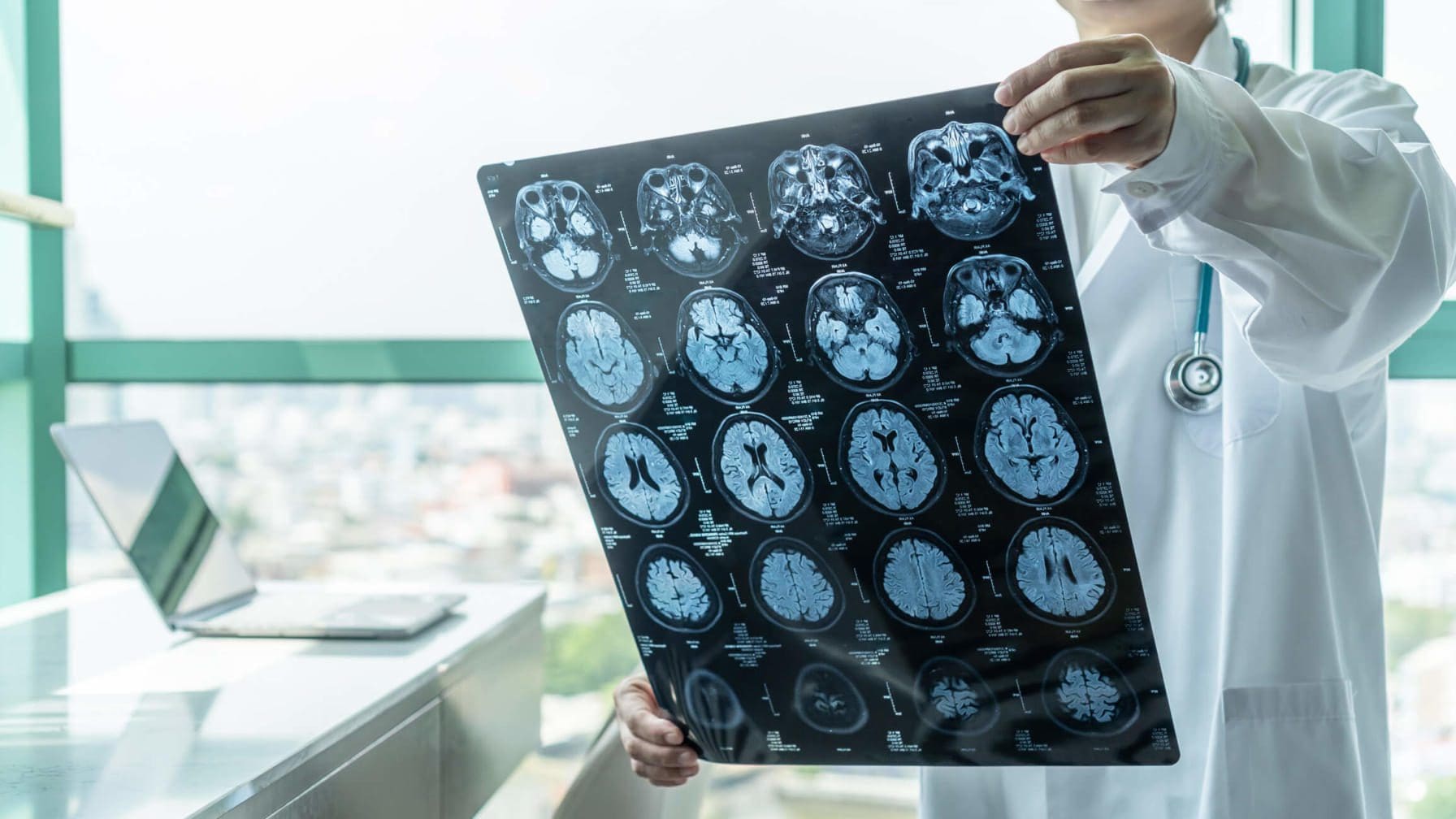 Child brain injuries