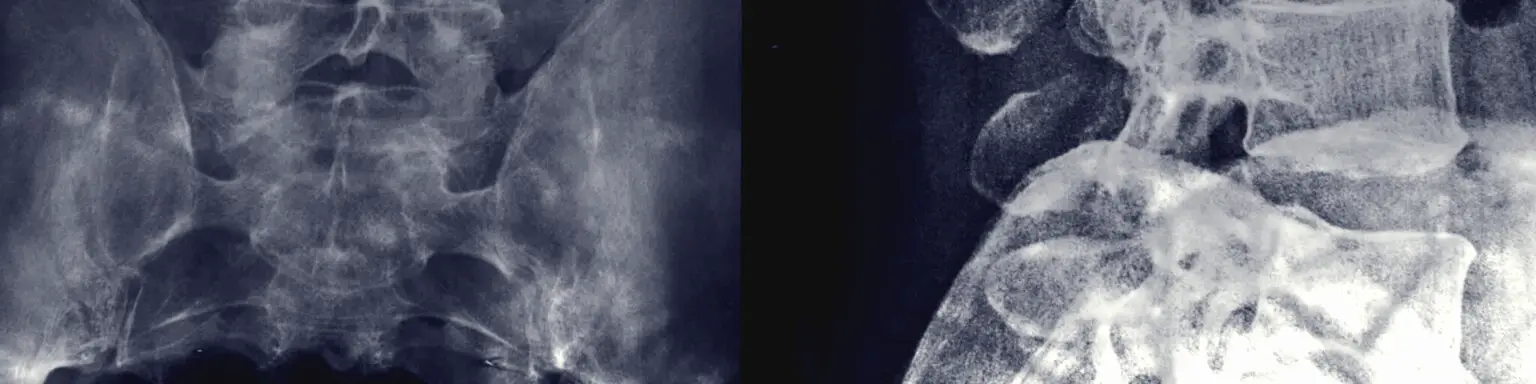 A Guide to Texas Personal Injury Law Personal Injury Law 04